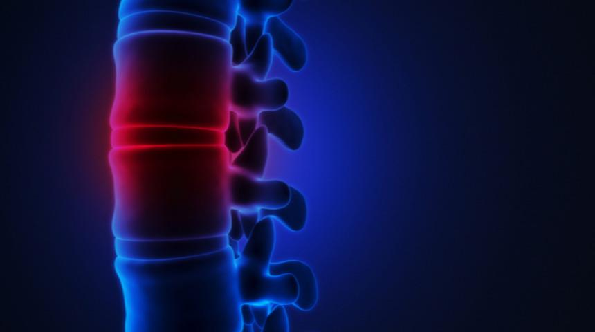 Mikrocerrahi ile bel fıtığı ameliyatının avantajları nelerdir?