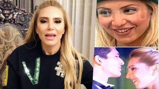 Işıl Reçber estetik iddialarına kızdı