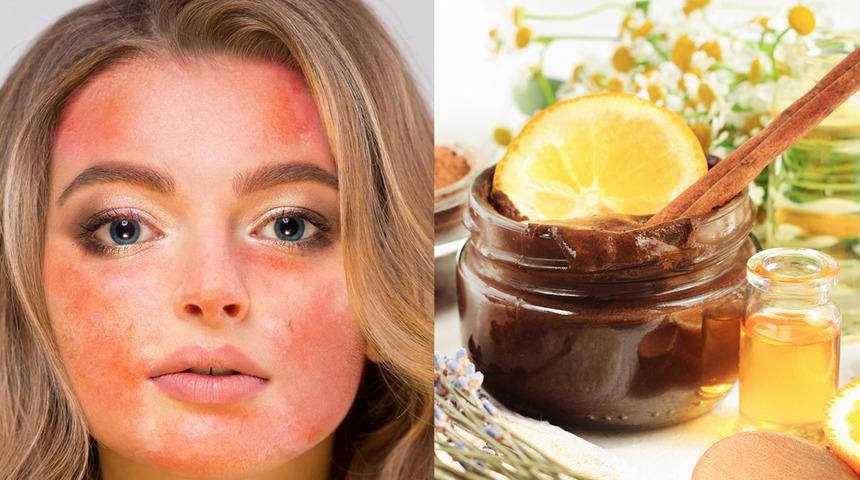 Cildinize bunu yapmayın! Çok yaygın şekilde kullanılan bu ürünler size zarar veriyor