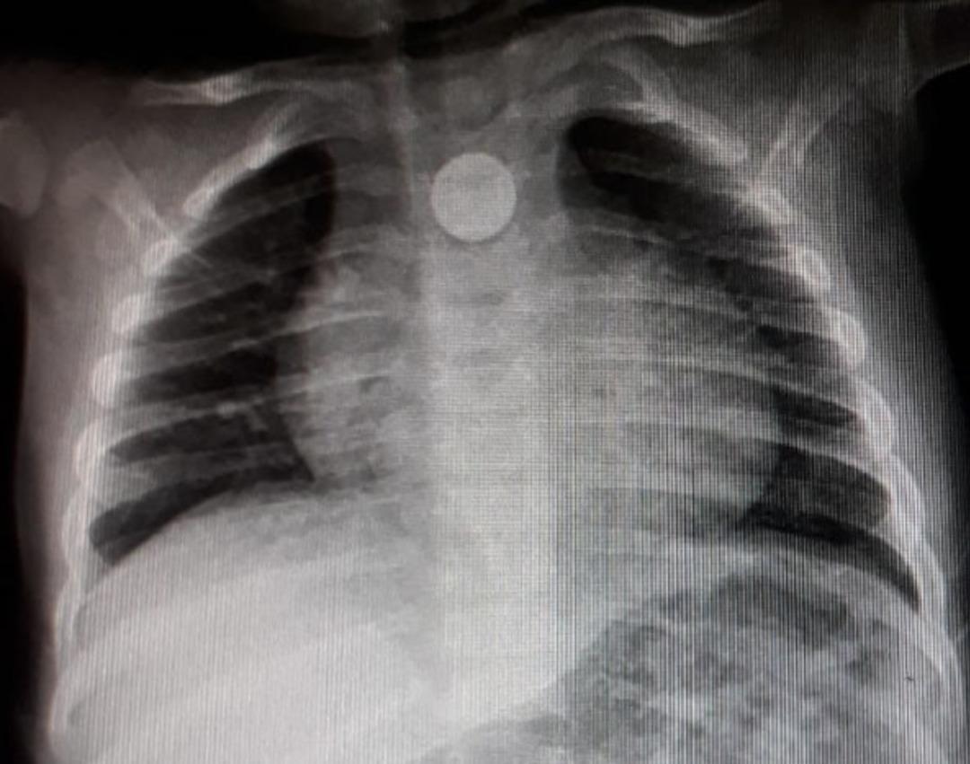 1 lira y&uuml;z&uuml;nden &ouml;l&uuml;yordu! Hayata b&ouml;yle d&ouml;nd&uuml;