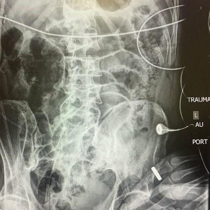 Dehşeti paylaştılar: 'Olduğum yer şu an böyle görünüyor!' G3