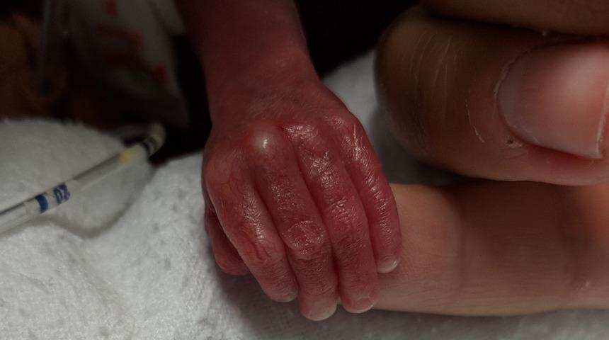 Türkiye’de her yıl 150 bin prematüre bebek dünyaya geliyor! 50 bini 1 kilogramın bile altında...