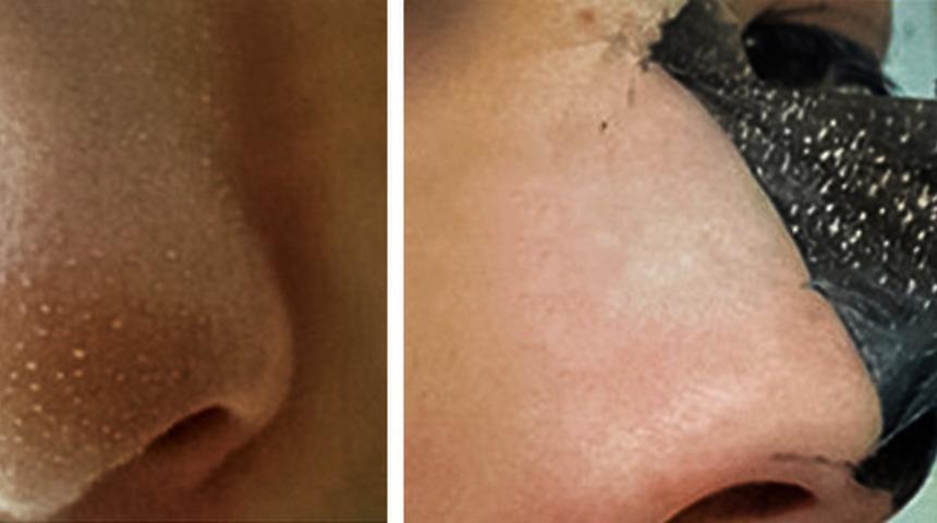  Kusursuz cildin anahtarı! Sadece 2 malzemeyle yapacağınız 10 doğal yüz maskesi tarifi