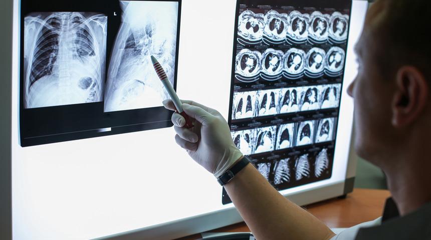 KOAH ne demek? KOAH tedavi sonrası ne yapmalı? KOAH ilaçları iyileşmek için yeterli mi?