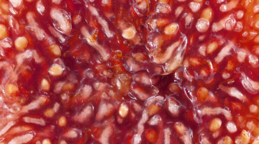 Kendisi küçük ama etkisi çok büyük! İncir çekirdeği yağı şifa dağıtıyor