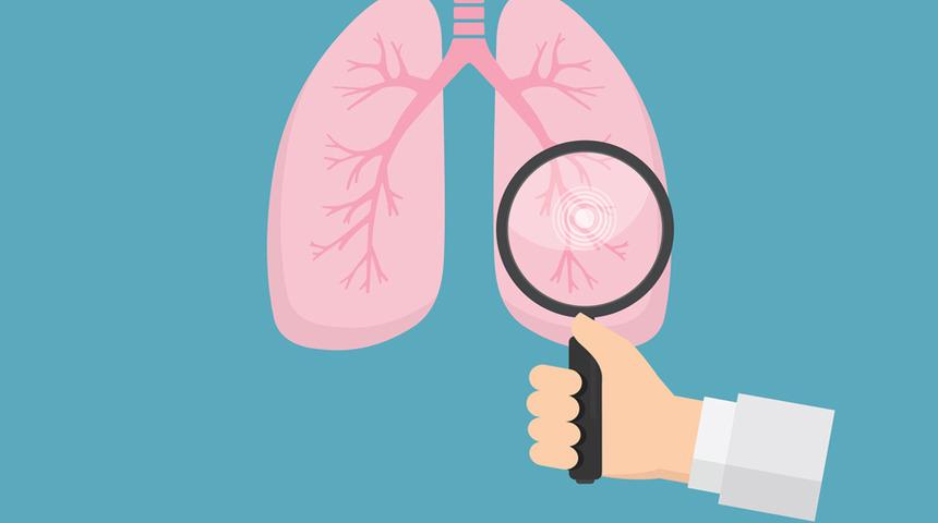 Sigara i&ccedil;meyenler neden akciğer kanseri oluyor? 