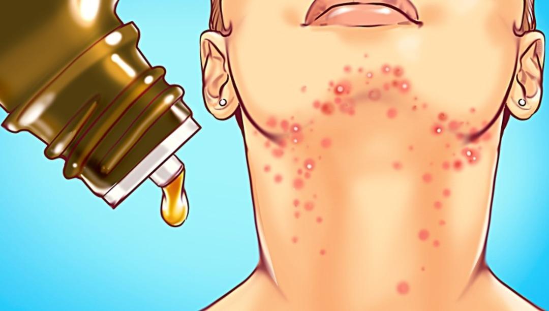 Hemen ilaca başvurmayın hormonlarınızı bu doğal yollarla dengeleyin