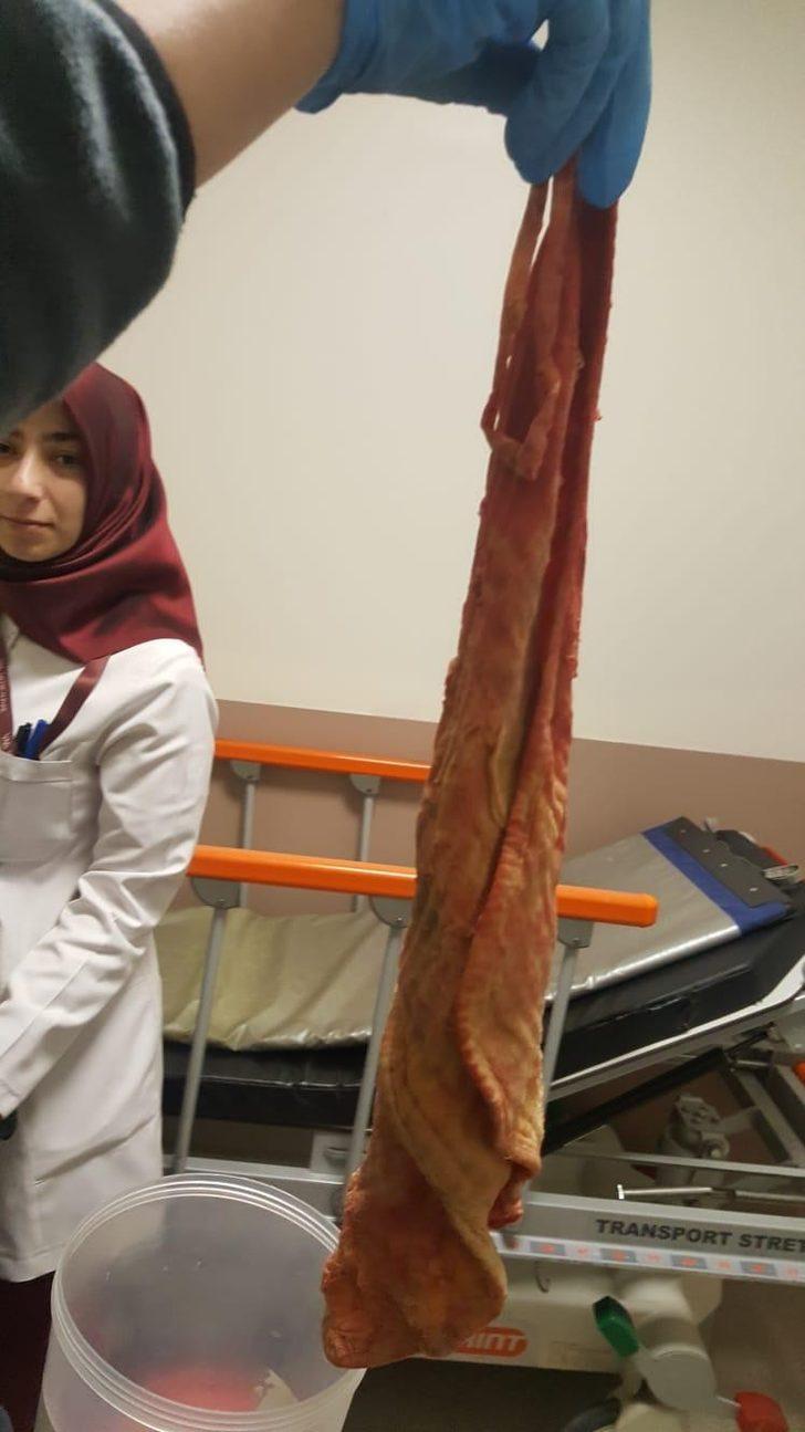 Karnından çıktı! Doktorlar bile şaşkına döndü G3