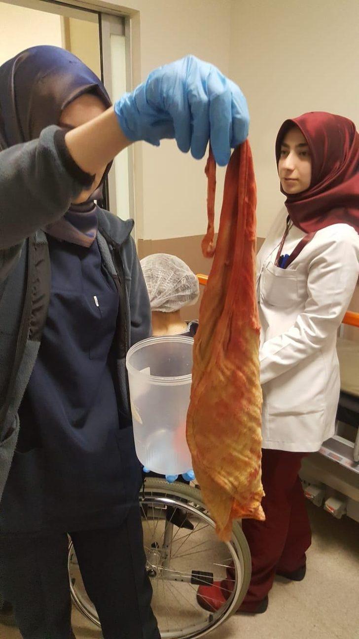 Karnından çıktı! Doktorlar bile şaşkına döndü G4