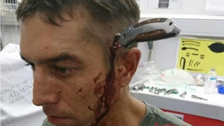 Başında 15 cm'lik bıçak saplı şekilde hastaneye geldi G4