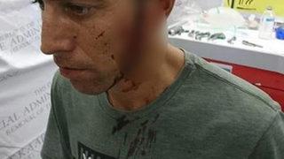 Başına 15 cm'lik bıçak saplandı!