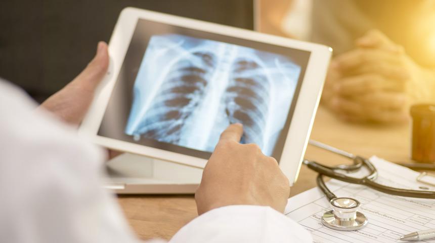 Tüberküloz nedir? Tüberküloz belirtileri ve tedavisi nasıl olur?