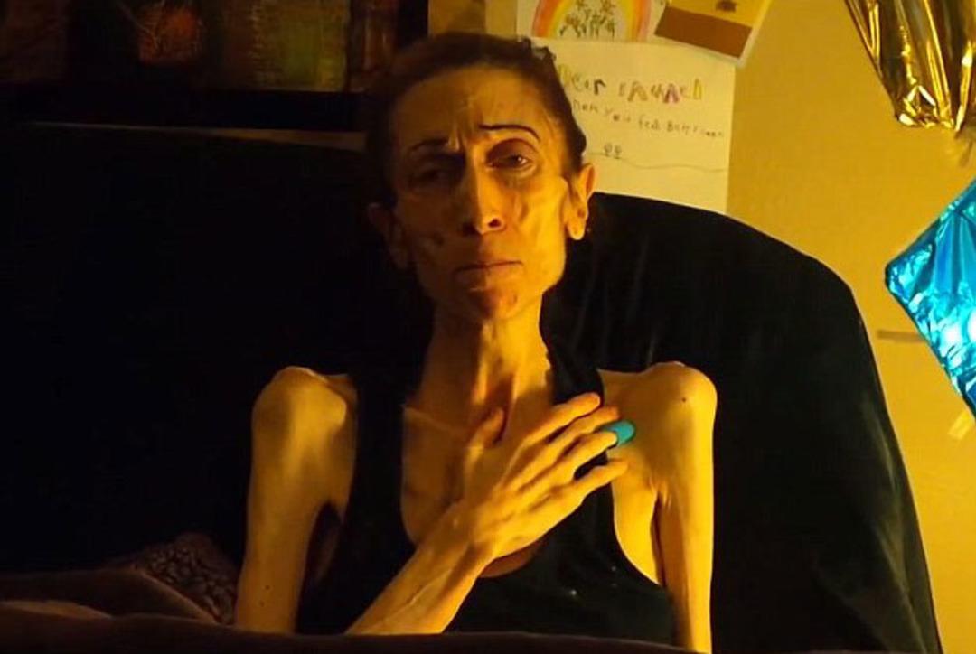 &Ouml;l&uuml;m&uuml;n kıyısından d&ouml;nd&uuml;! Son hali inanılmaz