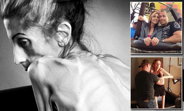 Ölümün kıyısından döndü! Son hali inanılmaz G5