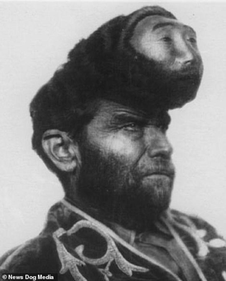 İşte sirklerin en 'ucube' karakterleri! G1