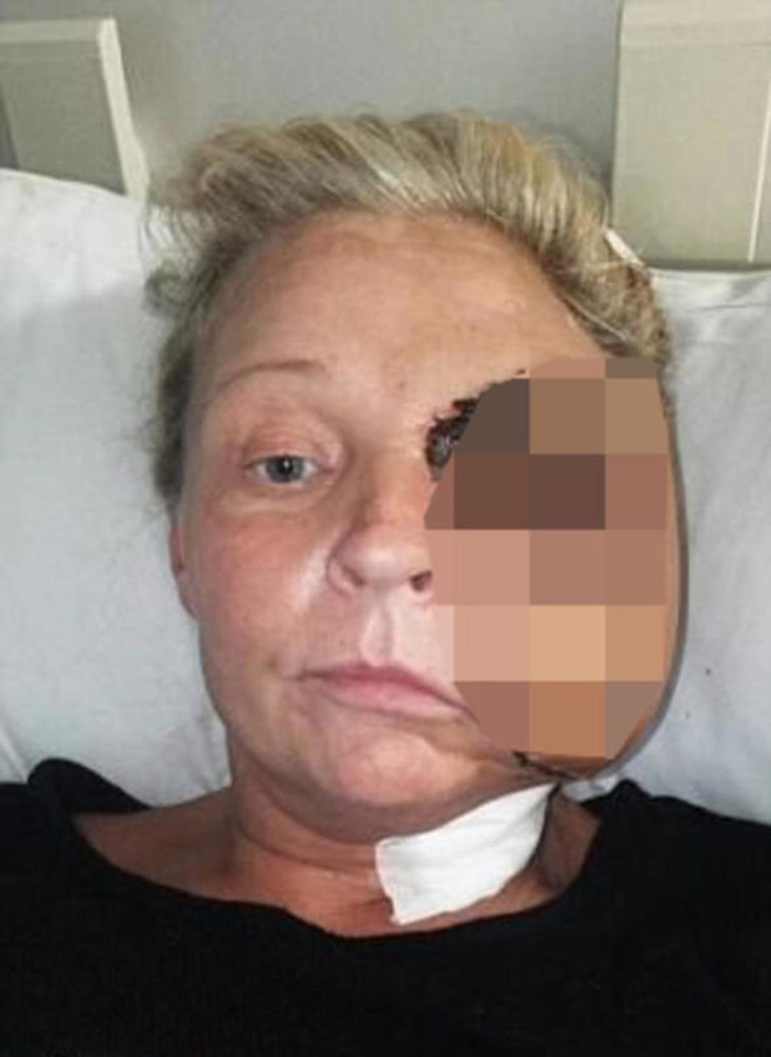 &Ccedil;ok tehlikeli! Et yiyen bakteri bu hale getirdi