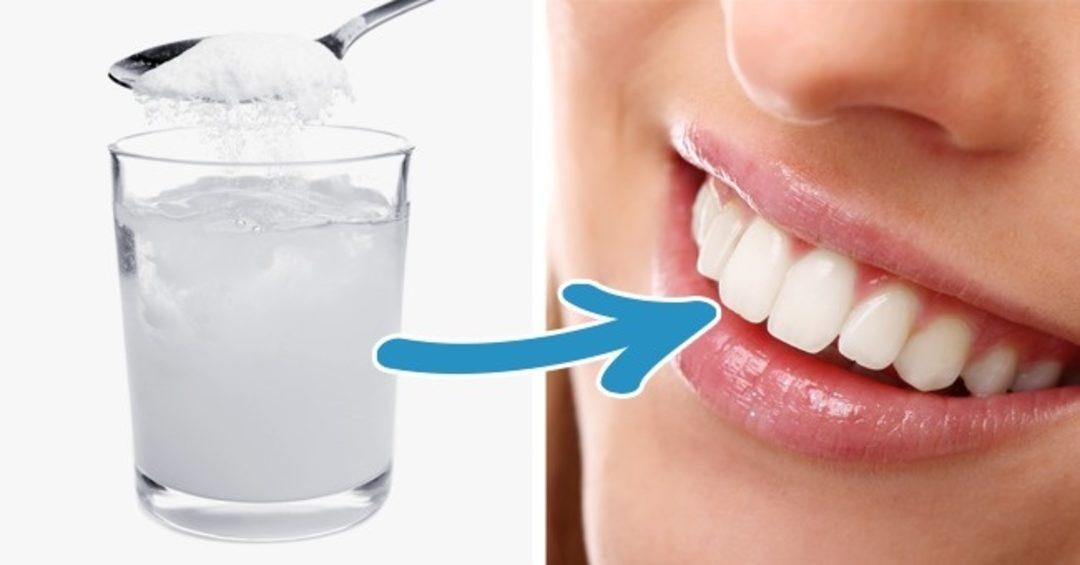 Bicarbonato para los dientes