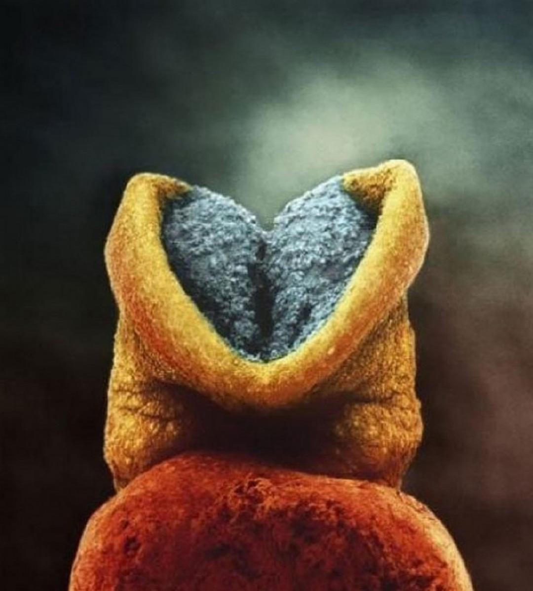 İşte bir mucize b&ouml;yle doğuyor...