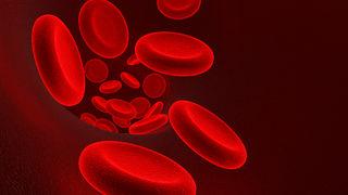 Demir eksikliği nedir? Belirtileri nasıl olur? Demir eksikliği en sık kimlerde görülür?