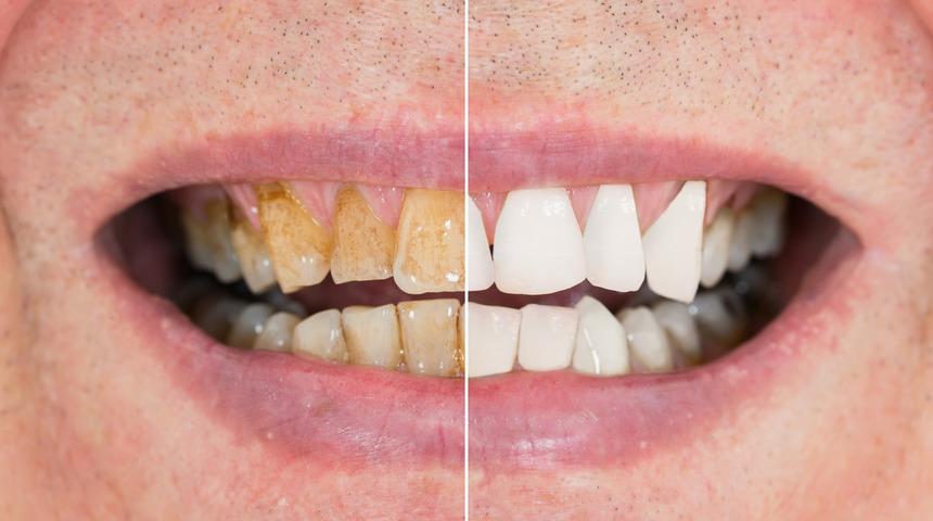 7 gün içinde görünüşünüzü değiştirecek 7 yağ