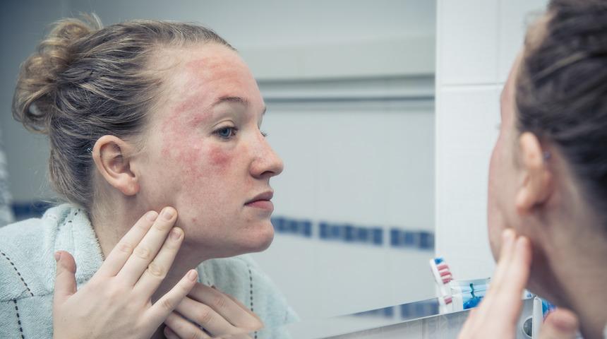 Kışın sıcak suyla banyo yapmak neden zararlıdır?