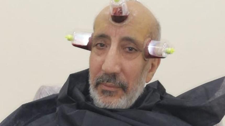 Abdurrahman Dilipak hacamat yaptırdı!