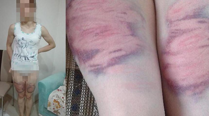 Sinirlendiği karısına 'Odaya ge&ccedil; soyun' dedi, oklavayla bu hale getirdi!