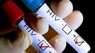 Türkiye'de HIV pozitif tanısı koyulan kişilerin sayısı 10 kat arttı
