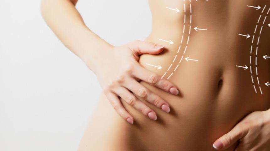 Aşama aşama g&ouml;bek deliği operasyonu