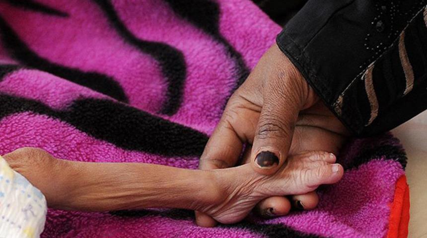 İnsani kriz: Milyonlarca Yemenli a&ccedil; uyuyor