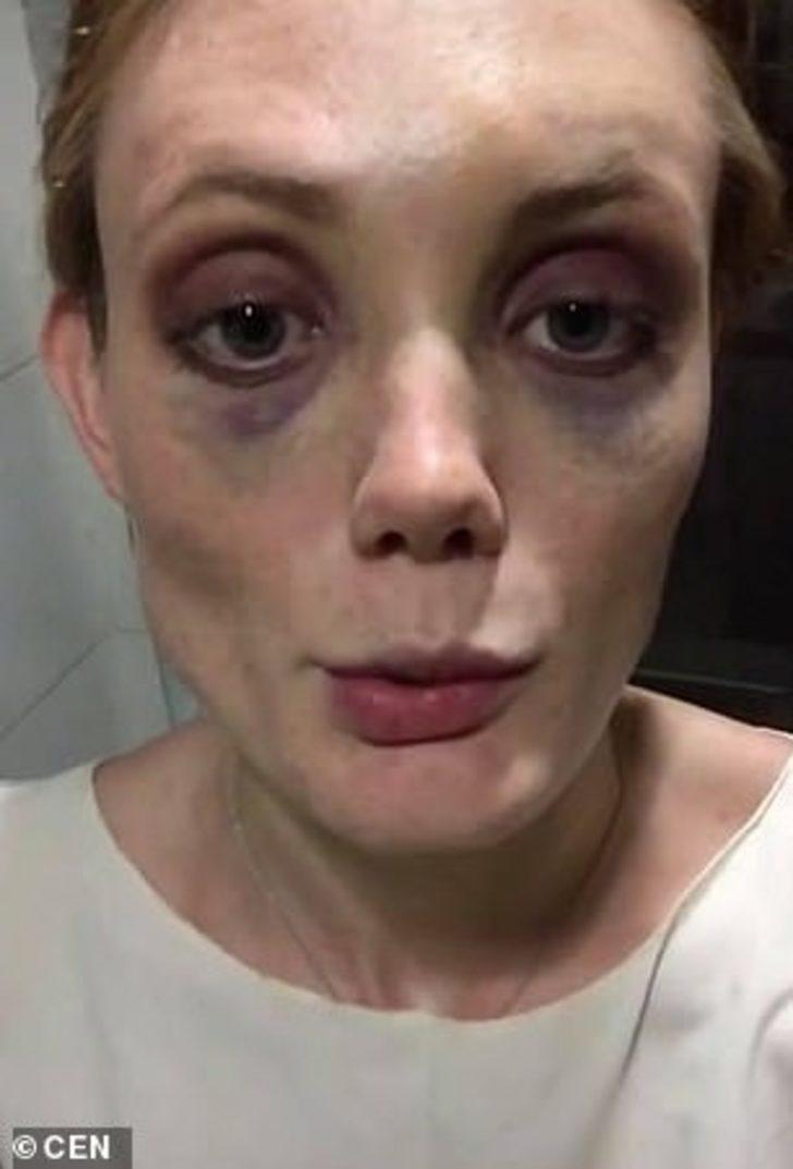 Önce bayıltana kadar dövdü, sonra tecavüz etti!  G5