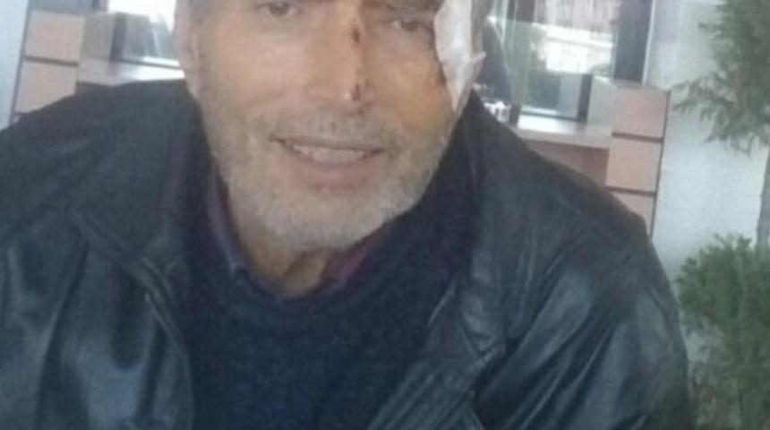 Bursa&rsquo;da Alzheimer hastası 2 g&uuml;nd&uuml;r kayıp