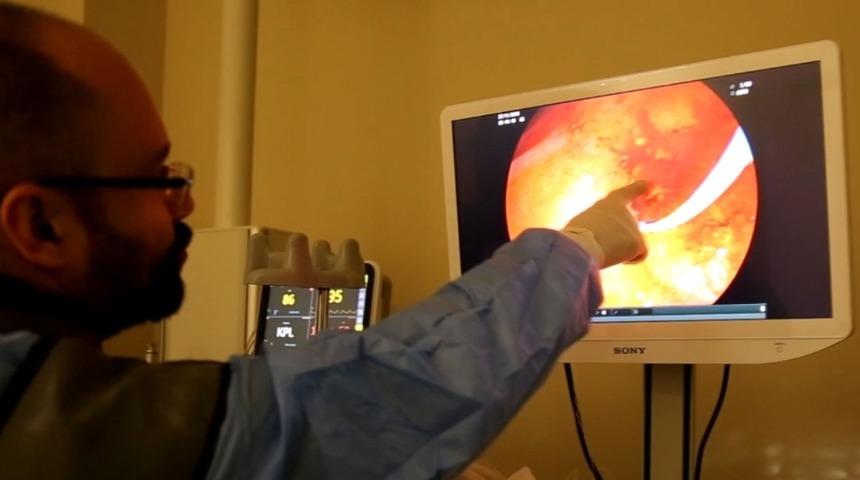 Kayseri Şehir Hastanesi&rsquo;nden ERCP Hizmeti