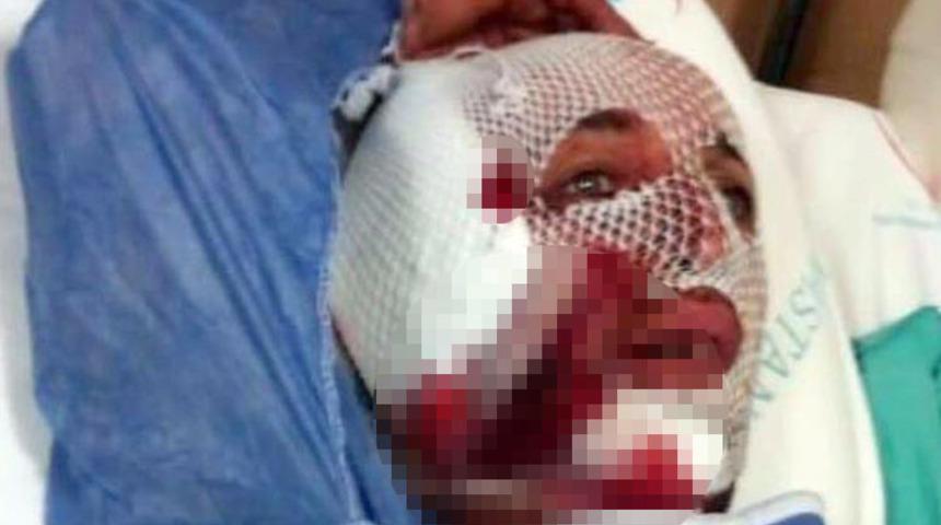 Korkunç olay! Fabrikadaki köpek kulağını parçaladı