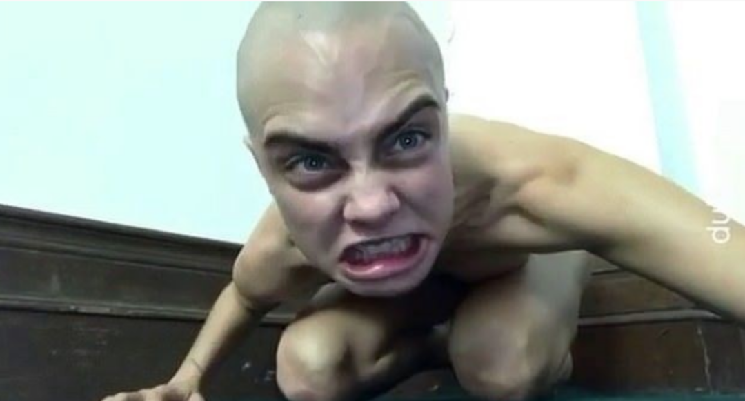 &Uuml;nl&uuml; model tanınmaz halde! Son hali şaşırttı 