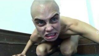 Ünlü model tanınmaz halde! Son hali şaşırttı 