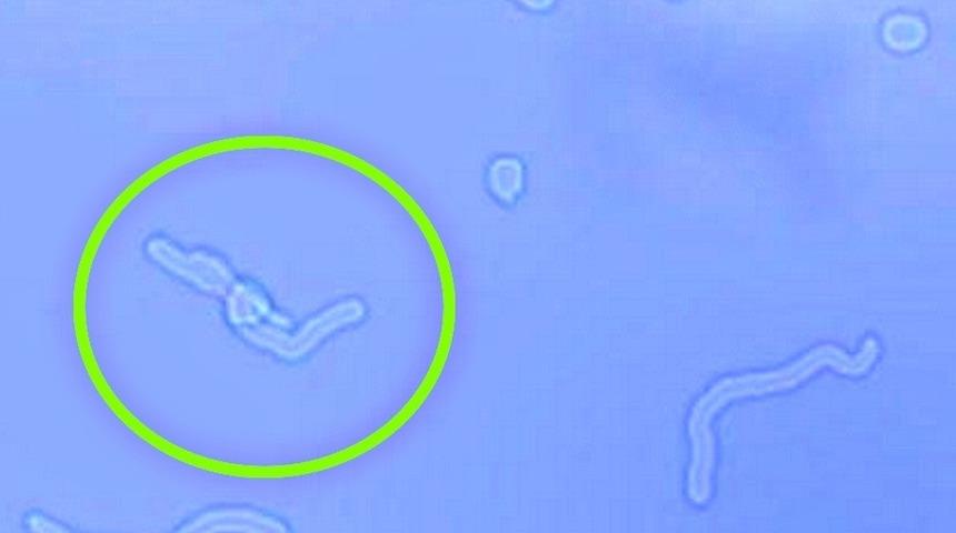 Uzmanlar uyarıyor! Eğer siz de bunları görüyorsanız dikkat