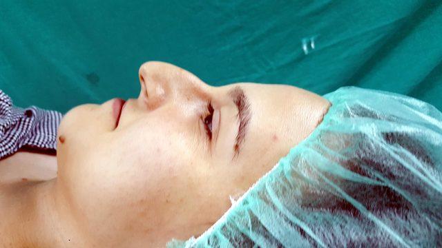 Karadeniz de burun estetiğinde artış 1