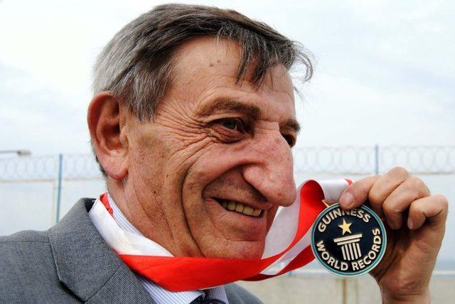 Karadeniz de burun estetiğinde artış 4