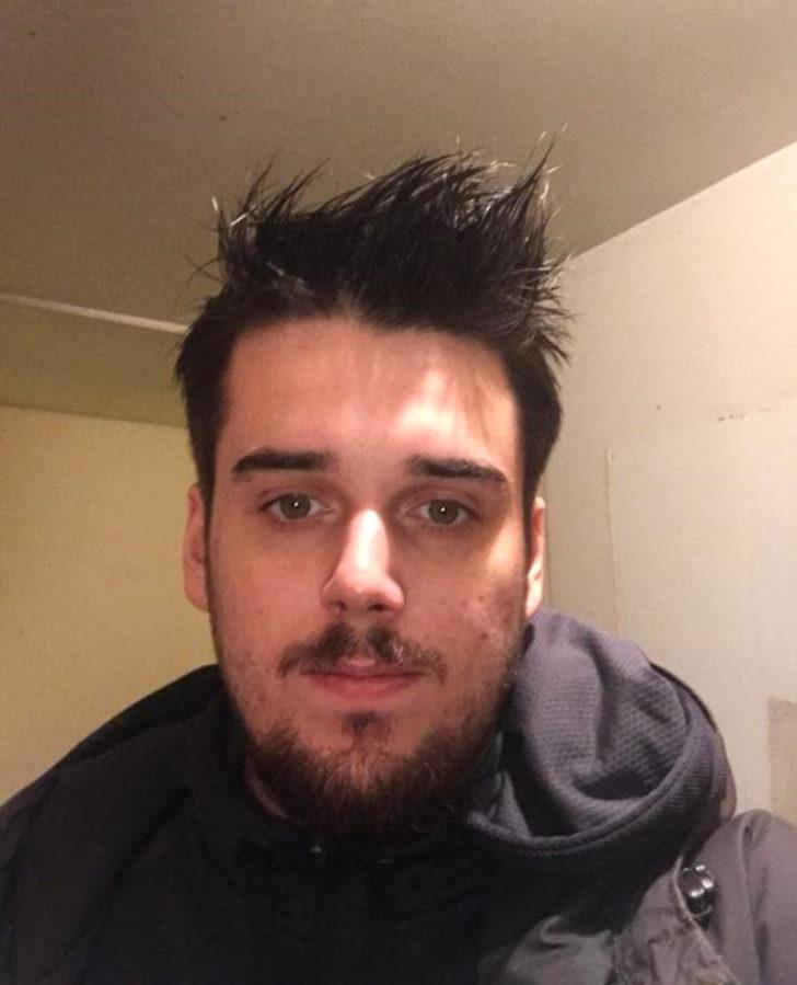 Yüzü paramparça olan gencin inanılmaz değişimi! G2