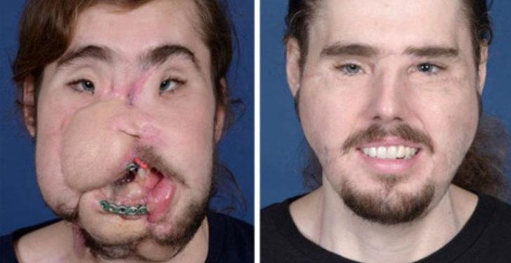 Yüzü paramparça olan gencin inanılmaz değişimi! G4