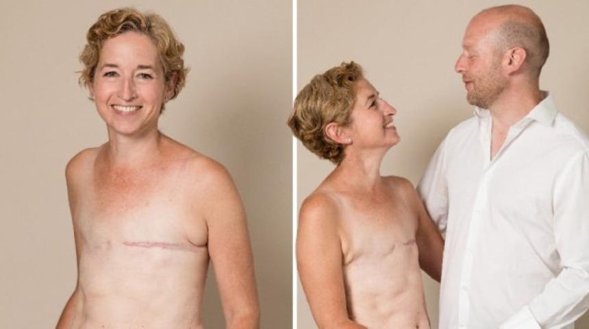 Meme kanserini 3 kez yendi! 'G&ouml;ğs&uuml;m&uuml;z olmadan da g&uuml;zeliz'