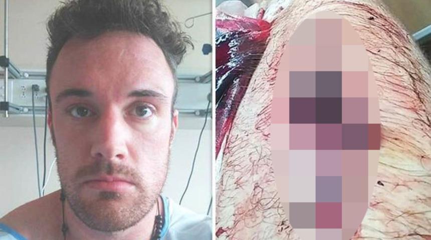 Steroid kullandı, hayatı kabusa d&ouml;nd&uuml;