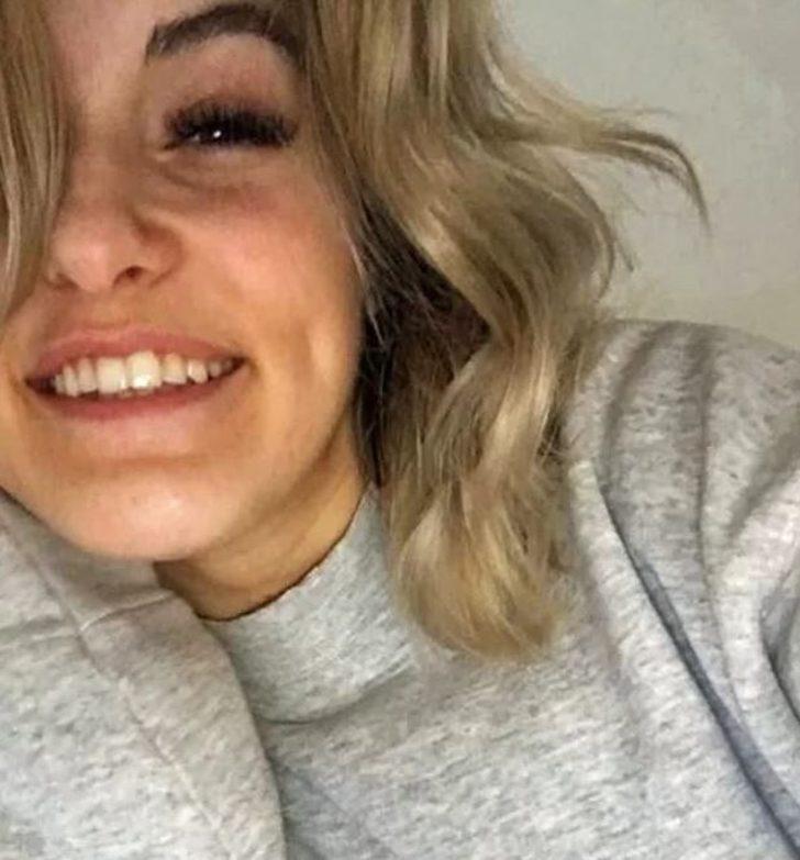 Kış alerjisi onu öldürecek! Üşüdüğü anda... G1