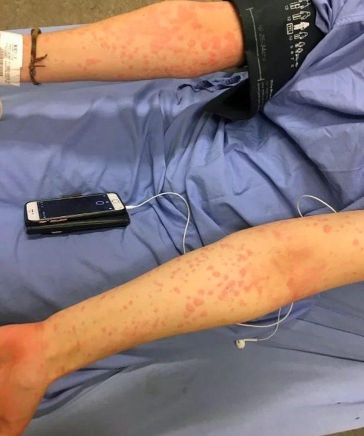 Kış alerjisi onu öldürecek! Üşüdüğü anda... G4