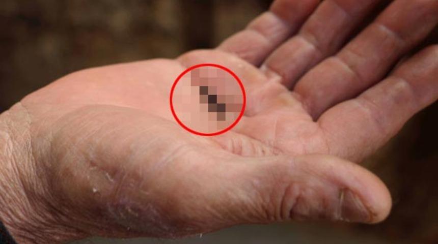 Hatay'da 10 gün önce ortaya çıktı! Evleri istila etti, halk tedirgin...