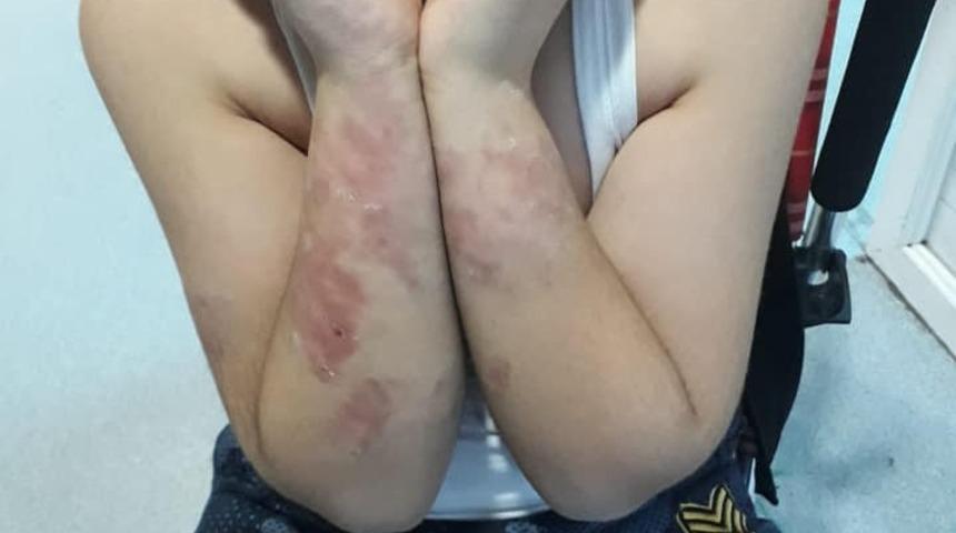 Uşak’ta engelli çocuğa darp iddiası