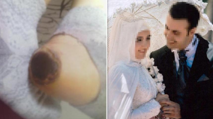 İzmir'de hastanede skandal olay! Doğuma girdi, bu hale geldi