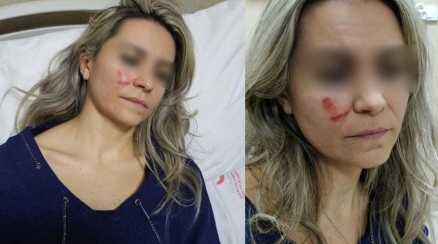 Korkunç iddia! Şanlıurfa'da doktor hastasının saldırısına uğradı