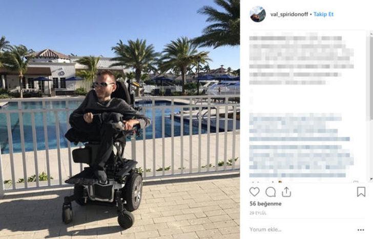 Kafa nakli gönüllüsü bambaşka bir hayat yaşıyor G2